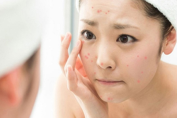 quy trình skincare cho da dầu mụn