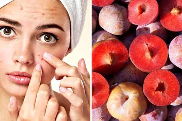 ăn mận có mọc mụn không