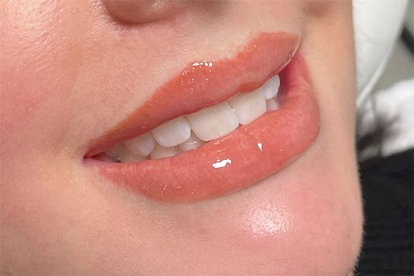 cấy môi sinh học bao lâu lên màu