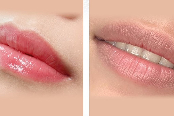 khử thâm môi kiêng ăn gì