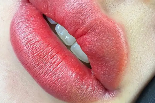 sau phun môi 1-2 ngày đầu