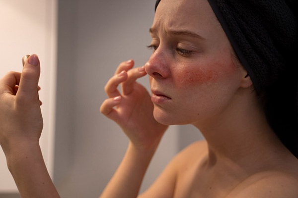 tác hại của việc rửa mặt bằng nước đá