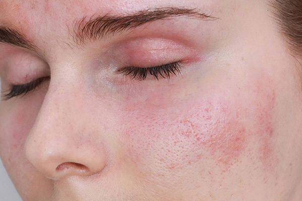 các lưu ý khi tẩy trang bằng dầu dừa