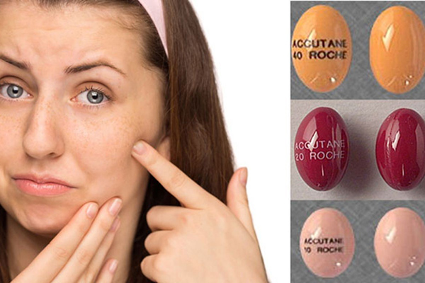 cách điều trị mụn chai hiệu quả