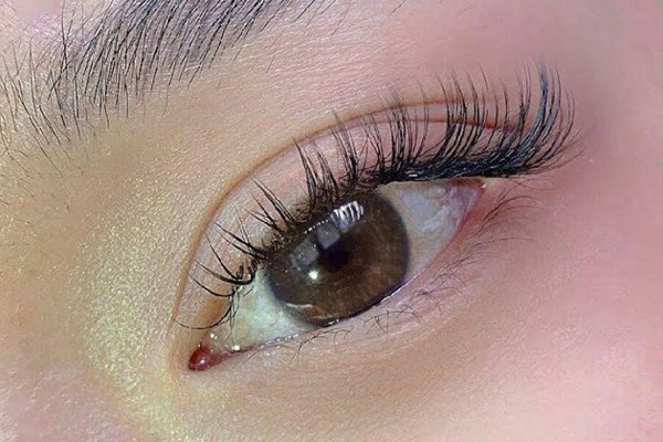 nối mi bị ngứa mắt phải làm sao