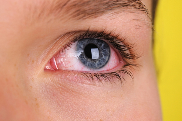 nối mi có gây hại cho mắt không