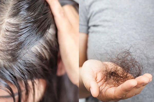 tác hại của dầu gội khô