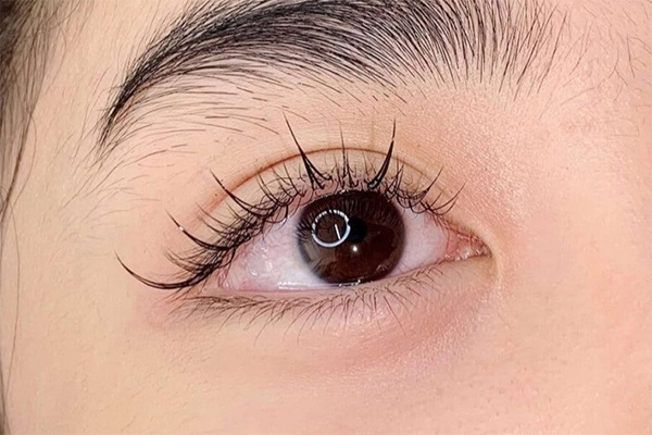 kiểm tra và định hình mi