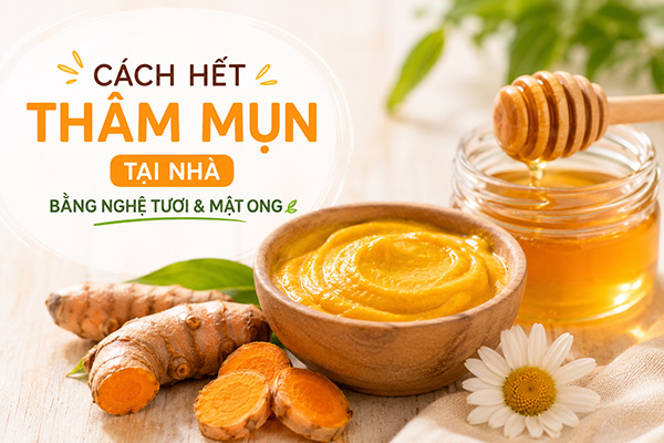 cách hết thâm mụn tại nhà